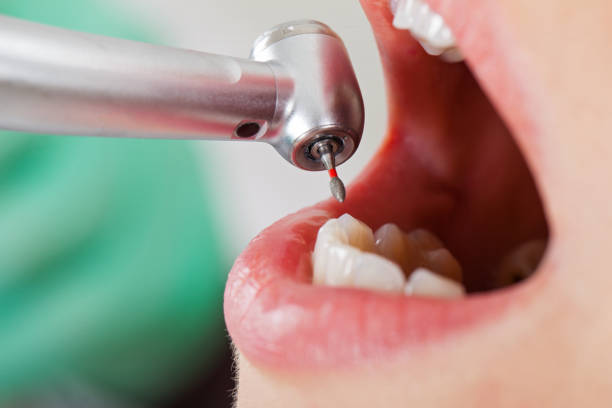 Best Cracked Tooth Emergency Dentist  in Jasonville, IN